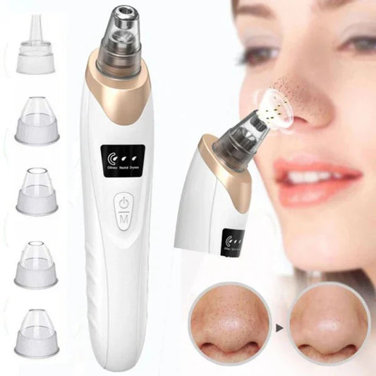 Skin Beauty Blackheads Remover Vaccum MM WONDERS